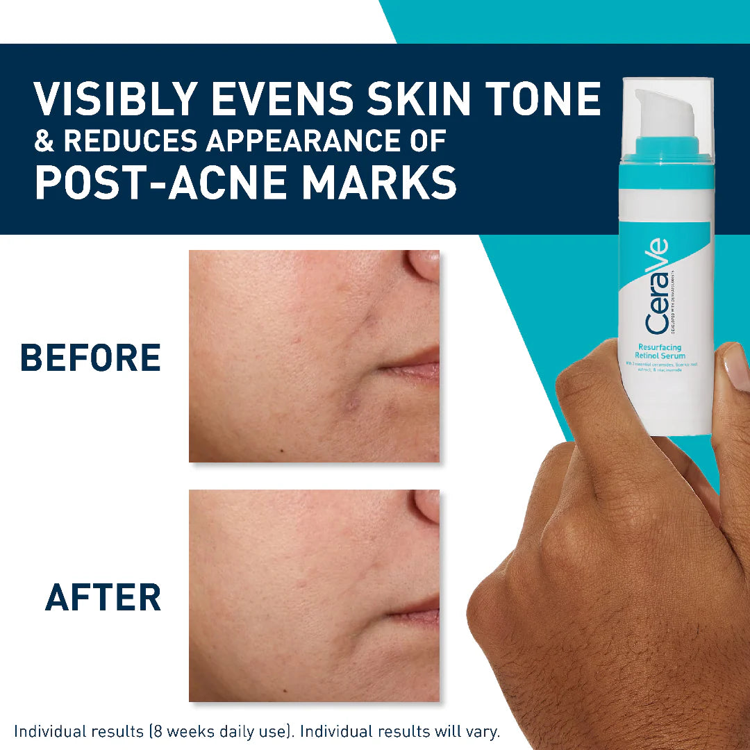 CeraVe Resurfacing Serum (30ml) (Original)