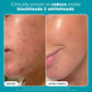Cerave Blemish Control Cleanser (236ml) (Original)