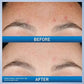 CeraVe Resurfacing Serum (30ml) (Original)