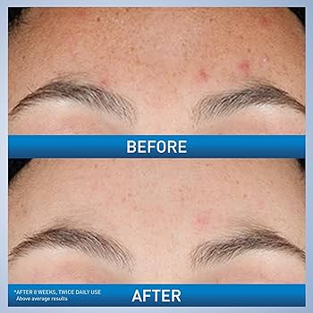 CeraVe Resurfacing Serum (30ml) (Original)