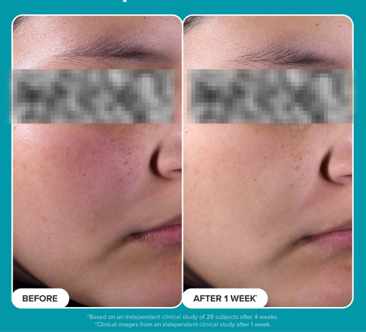 Cerave Blemish Control Cleanser (236ml) (Original)