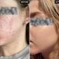 Ordinary Niacinamide 10% + Zinc 1% Serum (Original)
