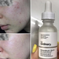Ordinary Niacinamide 10% + Zinc 1% Serum (Original)