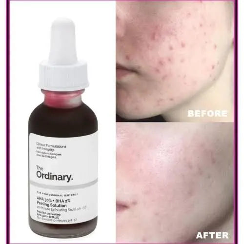 Peeling Solution AHA 30% + BHA 2% (Original)