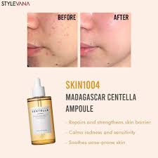 Centella Ampoule Facial Serum (Original)