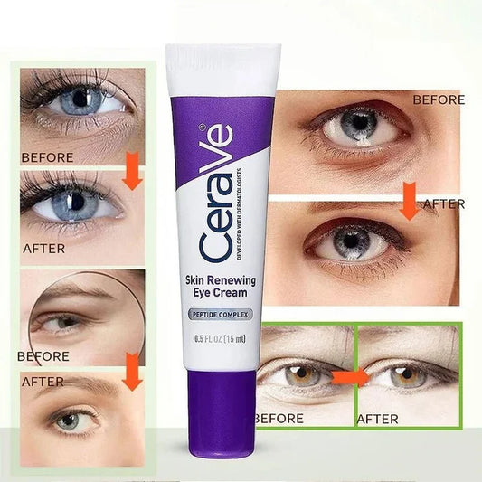 CeraVe Skin Renewing Eye Cream (Original)